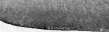 Dermographism: figure 9 from the 1928–1936 encyclopedia article