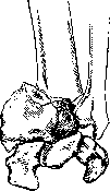 Forearm: figure 4 from the 1928–1936 encyclopedia article