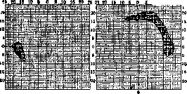 Scotoma: figure 2 from the 1928–1936 encyclopedia article