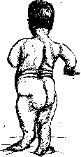 Lordosis: figure 8 from the 1928–1936 encyclopedia article