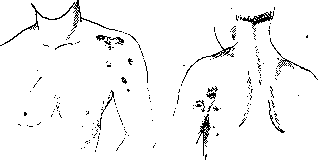 Scapula: figure 10 from the 1928–1936 encyclopedia article