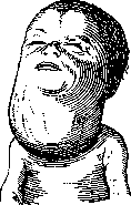 Hygroma: figure 1 from the 1928–1936 encyclopedia article