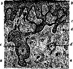 Atypical Growth and Structure: figure 1 from the 1928–1936 encyclopedia article