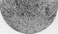 Typhus (188 Specific prophylaxis and serotherapy of): figure 4 from the 1928–1936 encyclopedia article
