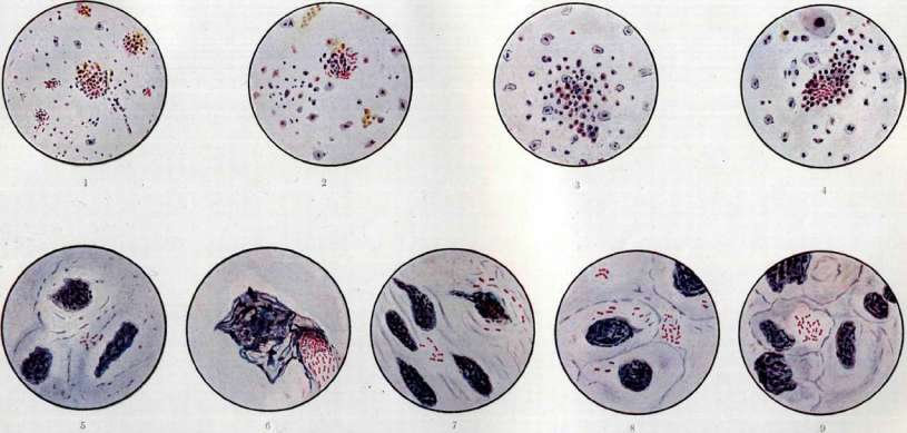 Typhus (188 Specific prophylaxis and serotherapy of): figure 2 from the 1928–1936 encyclopedia article