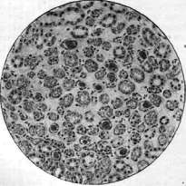 Typhus (188 Specific prophylaxis and serotherapy of): figure 5 from the 1928–1936 encyclopedia article