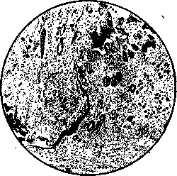 Wounds: figure 2 from the 1928–1936 encyclopedia article