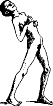 Hyperkinesis: figure 2 from the 1928–1936 encyclopedia article