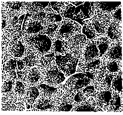 Lungs: figure 29 from the 1928–1936 encyclopedia article