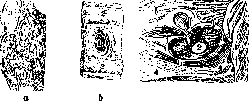 Lungs: figure 34 from the 1928–1936 encyclopedia article
