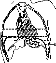 Lungs: figure 10 from the 1928–1936 encyclopedia article