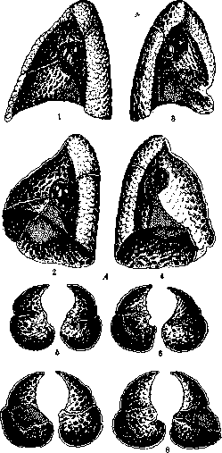 Lungs: figure 14 from the 1928–1936 encyclopedia article