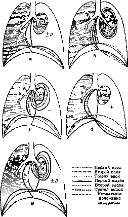 Lungs: figure 33 from the 1928–1936 encyclopedia article