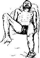 Dislocations: figure 15 from the 1928–1936 encyclopedia article