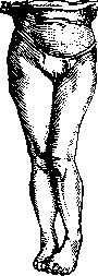 Dislocations: figure 13 from the 1928–1936 encyclopedia article