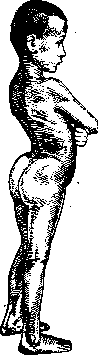 Dislocations: figure 24 from the 1928–1936 encyclopedia article