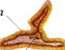 Soft Chancre: figure 4 from the 1928–1936 encyclopedia article