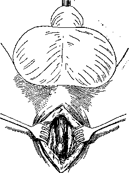 Urethra: figure 14 from the 1928–1936 encyclopedia article