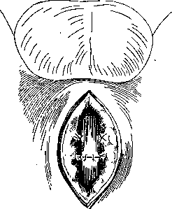 Urethra: figure 18 from the 1928–1936 encyclopedia article