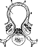 Spina Bifida: figure 10 from the 1928–1936 encyclopedia article