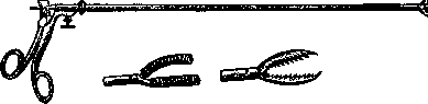 Esophagoscopy: figure 6 from the 1928–1936 encyclopedia article