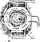 Staphyloma: figure 6 from the 1928–1936 encyclopedia article