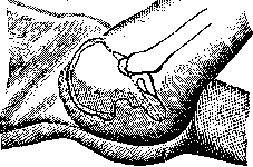 Roser-Nélaton Line: figure 1 from the 1928–1936 encyclopedia article