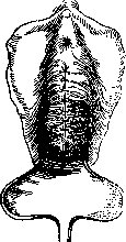 Colporrhaphy: figure 3 from the 1928–1936 encyclopedia article