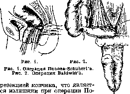 Colpopoesis: figure 1 from the 1928–1936 encyclopedia article