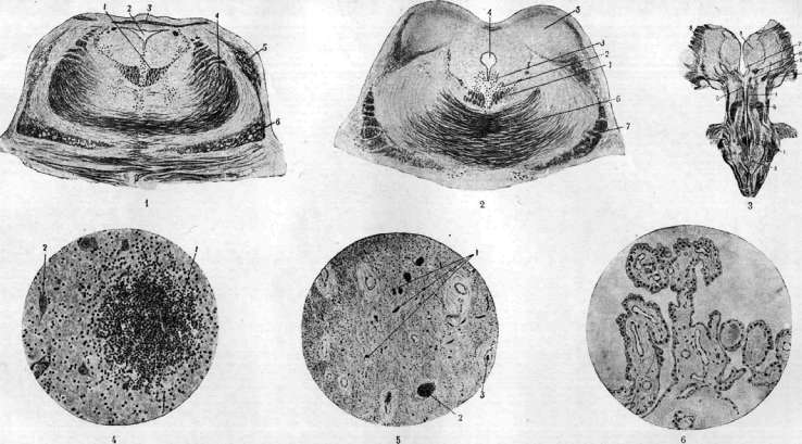 Bean: figure 1 from the 1928–1936 encyclopedia article