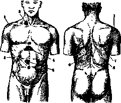 Cholelithiasis: figure 2 from the 1928–1936 encyclopedia article