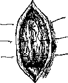 Gastropexy: figure 2 from the 1928–1936 encyclopedia article