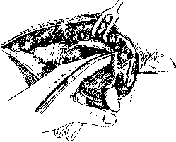 Rectum: figure 25 from the 1928–1936 encyclopedia article