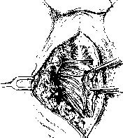 Rectum: figure 20 from the 1928–1936 encyclopedia article