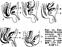 Rectum: figure 13 from the 1928–1936 encyclopedia article