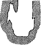 Amputation: figure 2 from the 1928–1936 encyclopedia article