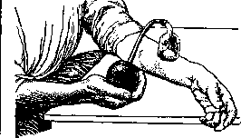 Abscess: figure 5 from the 1928–1936 encyclopedia article