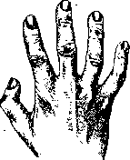 Laundry: figure 9 from the 1928–1936 encyclopedia article