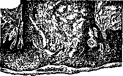 Adamantinoma: figure 3 from the 1928–1936 encyclopedia article