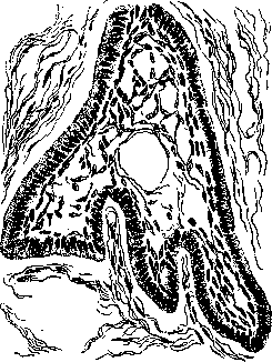 Adamantinoma: figure 1 from the 1928–1936 encyclopedia article