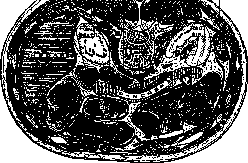 Retroperitoneal Space: figure 5 from the 1928–1936 encyclopedia article