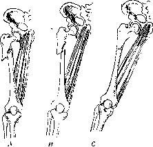 Fractures: figure 18 from the 1928–1936 encyclopedia article