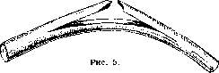 Fractures: figure 4 from the 1928–1936 encyclopedia article