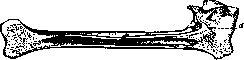 Ankylosis: figure 1 from the 1928–1936 encyclopedia article