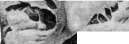 Diabetes Mellitus: figure 1 from the 1928–1936 encyclopedia article
