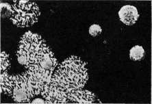 Diabetes Mellitus: figure 6 from the 1928–1936 encyclopedia article