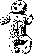 Malformations: figure 2 from the 1928–1936 encyclopedia article