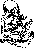 Malformations: figure 6 from the 1928–1936 encyclopedia article