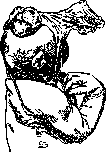 Malformations: figure 1 from the 1928–1936 encyclopedia article