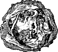 Bursitis: figure 1 from the 1928–1936 encyclopedia article